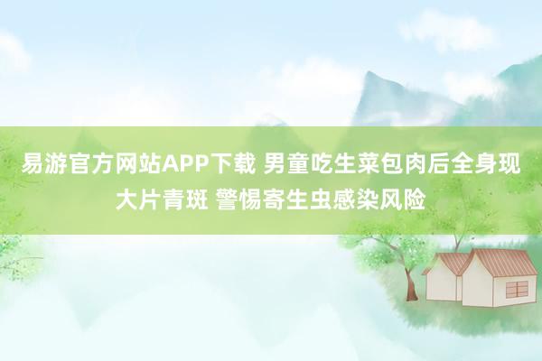 易游官方网站APP下载 男童吃生菜包肉后全身现大片青斑 警惕寄生虫感染风险
